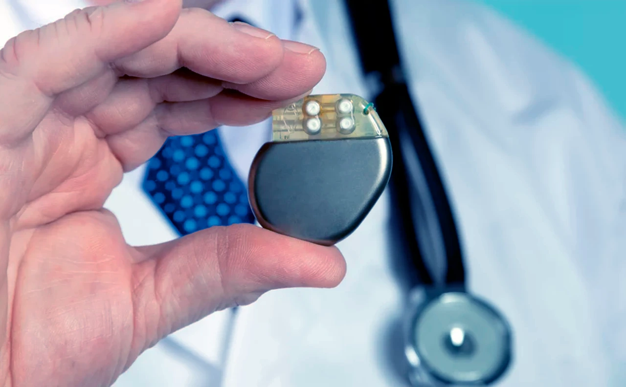 Marcapasos y fisioterapia: qué debes saber antes de comenzar un tratamiento