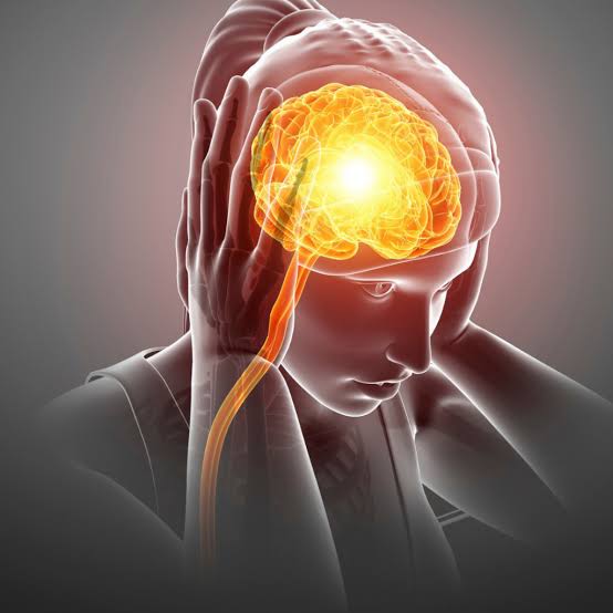 Migraña, vértigo, cefalea y cervicalgia: ¿qué relación tienen con el cuello?